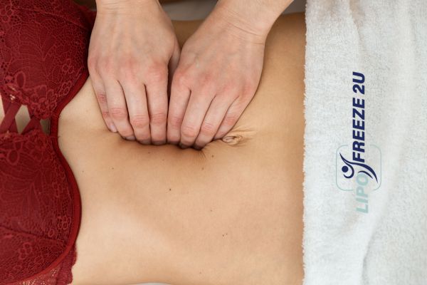 diastasis recti treatment Amersham