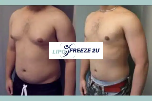 How Long Does It Take to See Results Amersham?