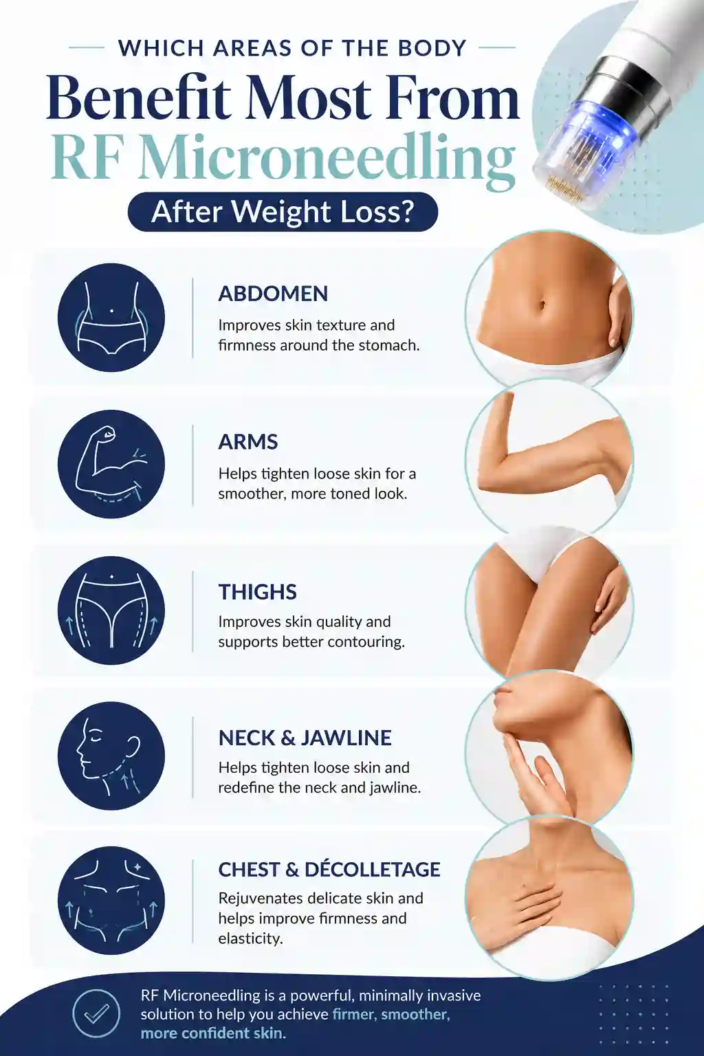 Which Areas of the Body Benefit Most From RF Microneedling After Weight Loss Amersham